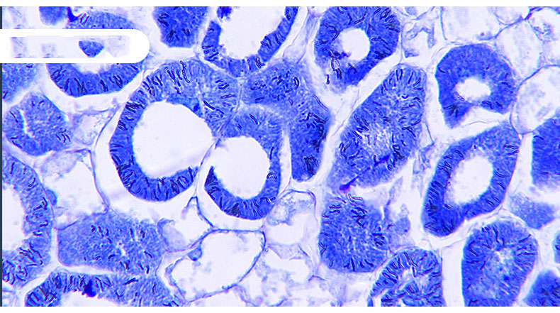 Trinocular biological microscope laboratory observation of microbial cells mite sewage