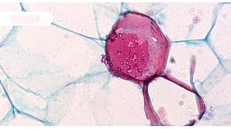 Trinocular biological microscope laboratory observation of microbial cells mite sewage