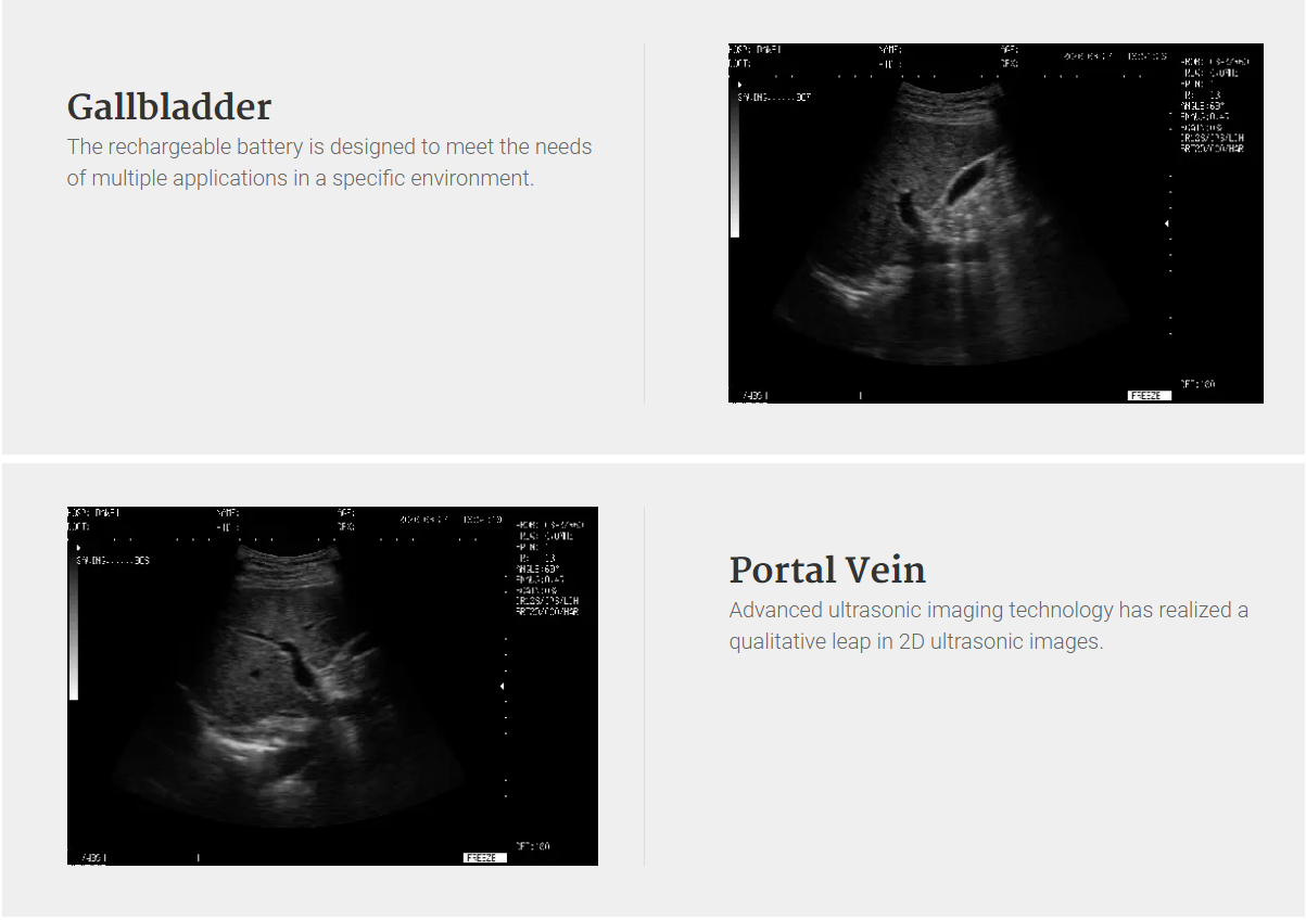 Low cost Trolley ultrasound full digital machine YH-350 ultrasound scan