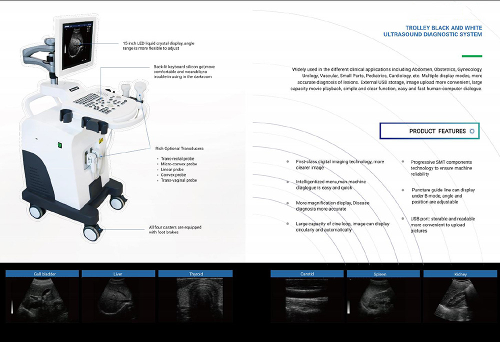 Low cost Trolley ultrasound full digital machine YH-350 ultrasound scan