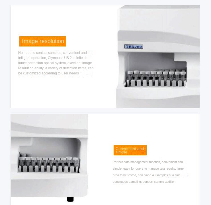 Supply automatic stool analyzer TEX760 laboratory equipment