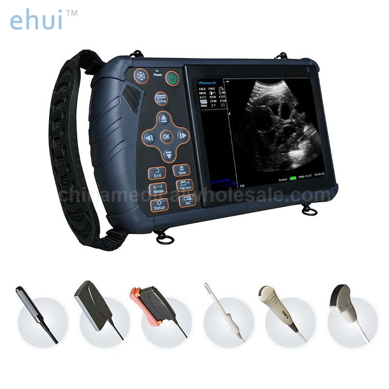 Mini hand-held cow pregnancy ultrasound scanner