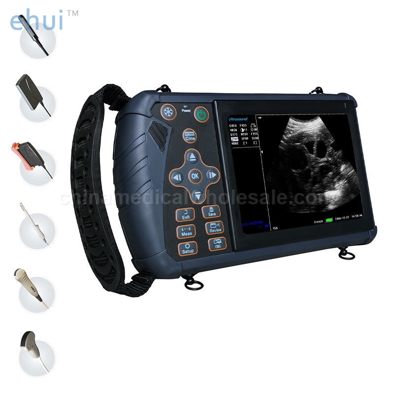 Portable handheld wireless veterinary ultrasound scanner pregnancy equipment