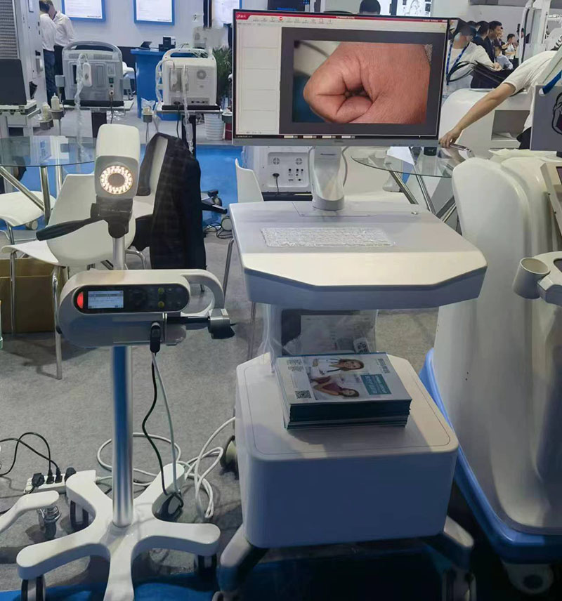 Electronic colposcopy 2 megapixel gynecologic endoscopy system