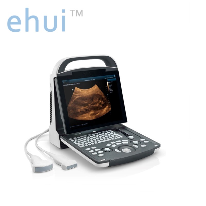 Digital portable ultrasound diagnostic system DP-20 B ultrasound machine