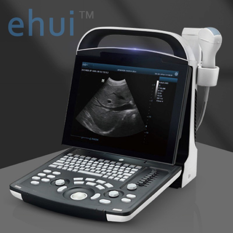 Digital portable ultrasound diagnostic system DP-20 B ultrasound machine