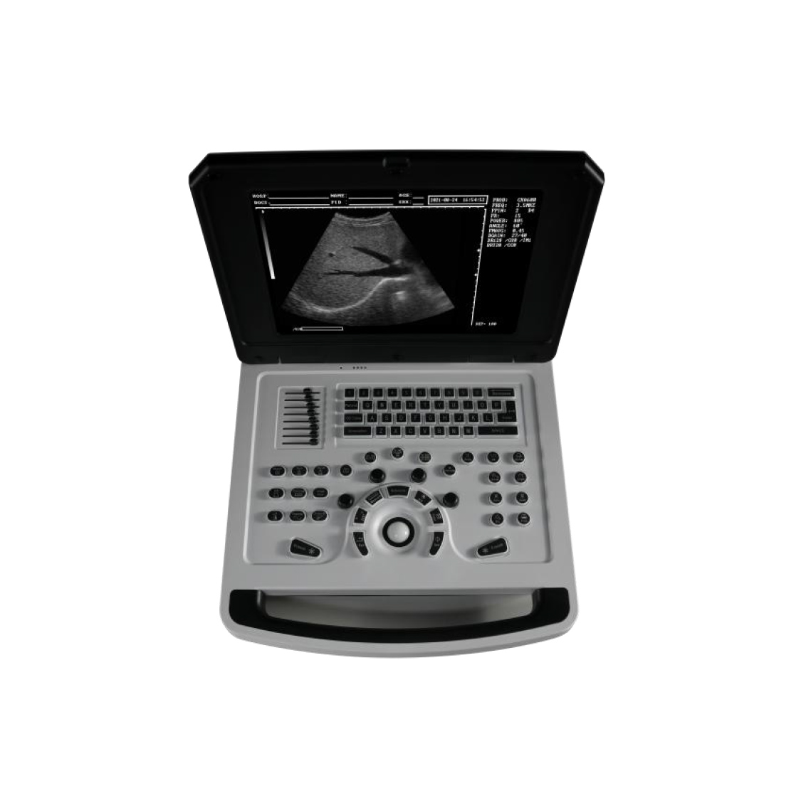 Full digital ultrasound diagnostic instrument notebook black and white B ultrasound machine