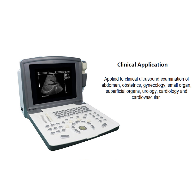 Medical Portable Ultrasonic Diagnostic Instrument Doppler Ultrasound Machine