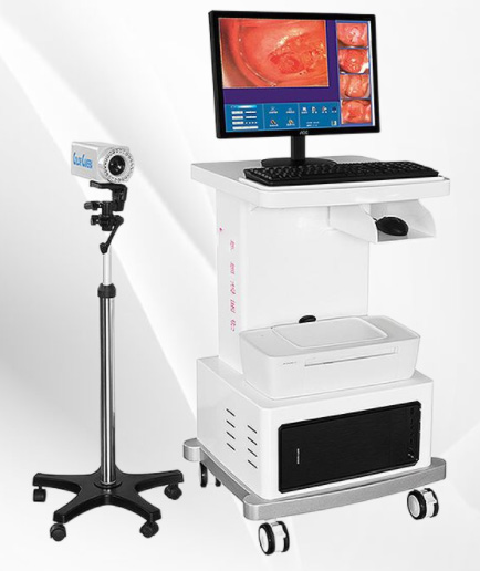 Electronic colposcopy 2 megapixel gynecologic endoscopy system