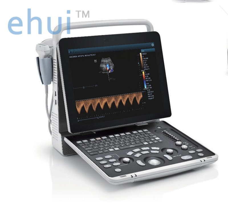 Portable full digital color ultrasound Z50BW outpatient ultrasound