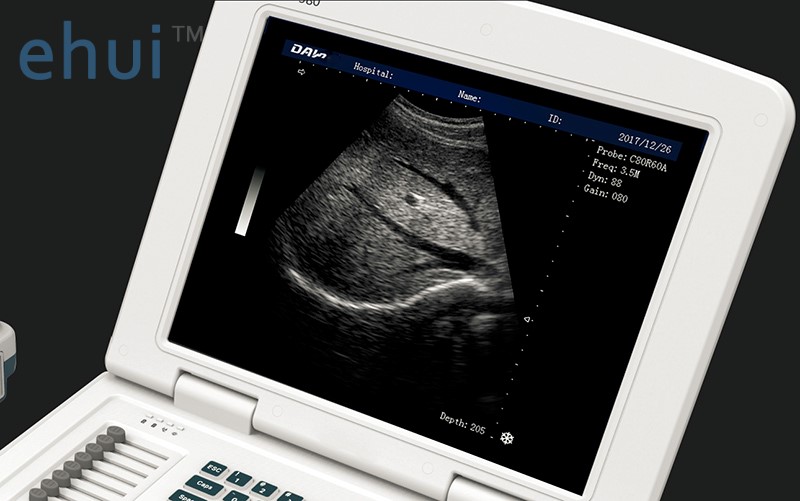 Portable laptop B/W ultrasound machine price full digital ultrasound scanner W580