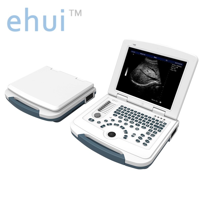 Portable laptop B/W ultrasound machine price full digital ultrasound scanner W580