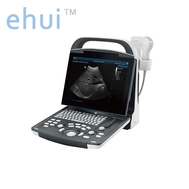 Digital portable ultrasound diagnostic system DP-20 B ultrasound machine