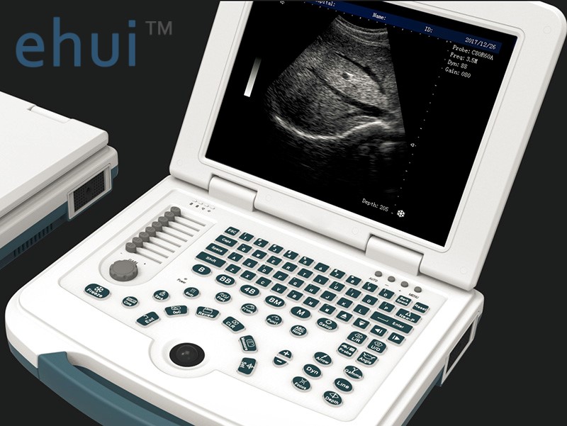 Portable laptop B/W ultrasound machine price full digital ultrasound scanner W580