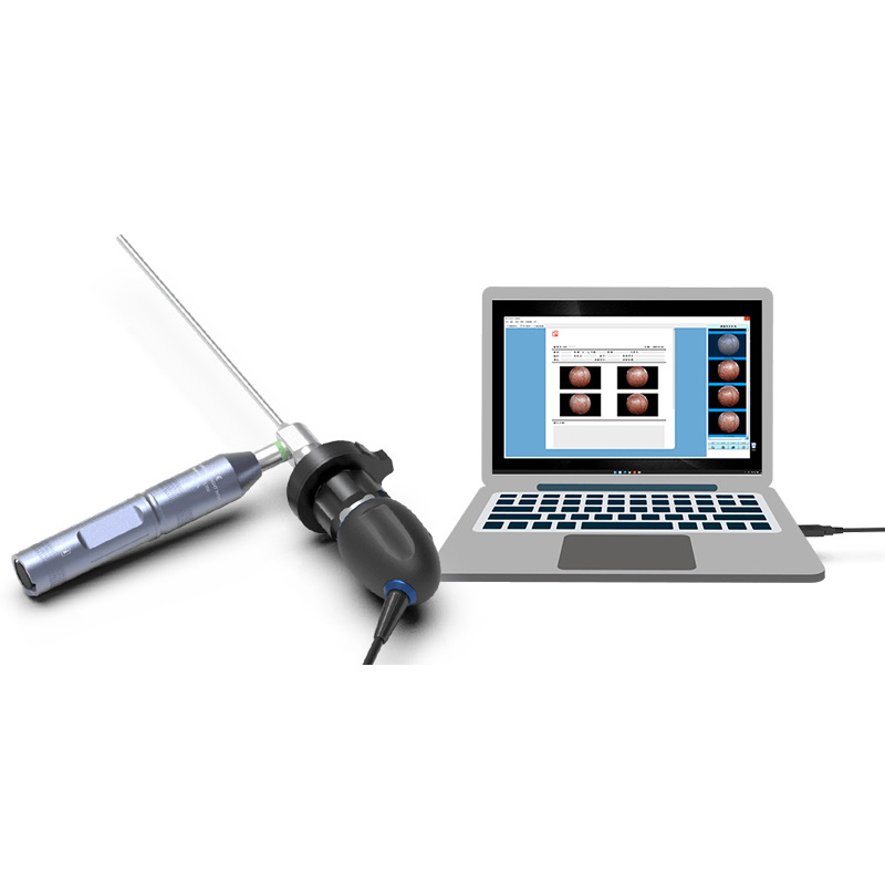 Foreign trade handheld high-definition endoscope system