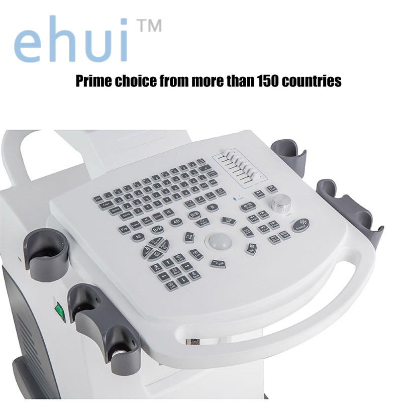 Low cost Trolley ultrasound full digital machine YH-350 ultrasound scan