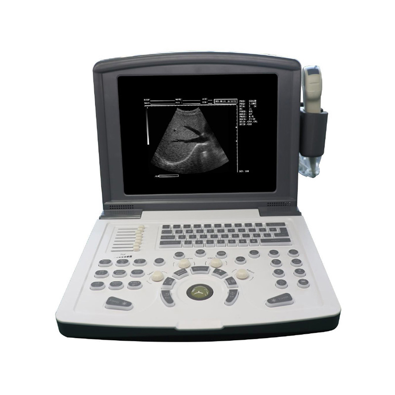 Medical Portable Ultrasonic Diagnostic Instrument Doppler Ultrasound Machine