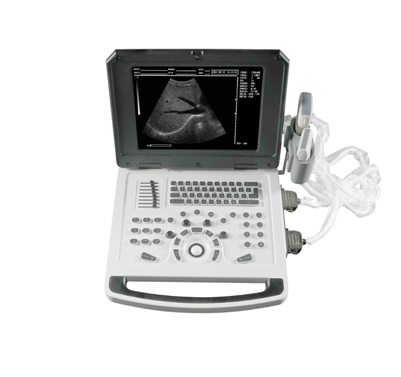 Full digital ultrasound diagnostic instrument notebook black and white B ultrasound machine