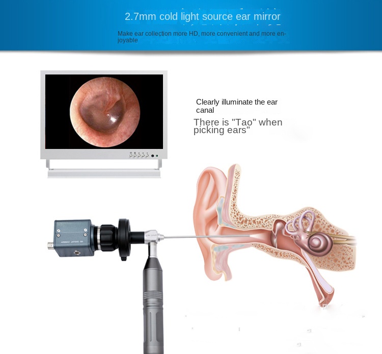 Ear cavity visual lens sinus mirror HD 10-inch large screen cold light source endoscope