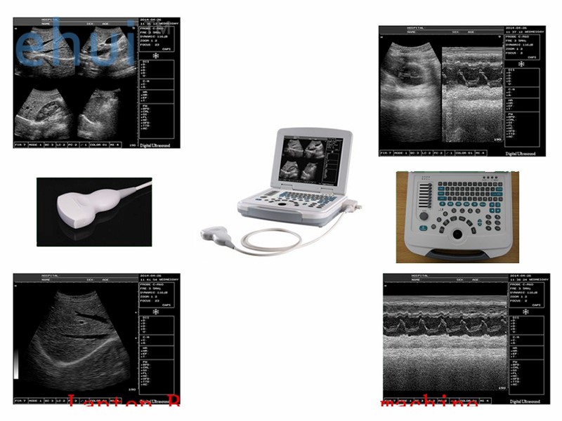 Portable laptop B/W ultrasound machine price full digital ultrasound scanner W580