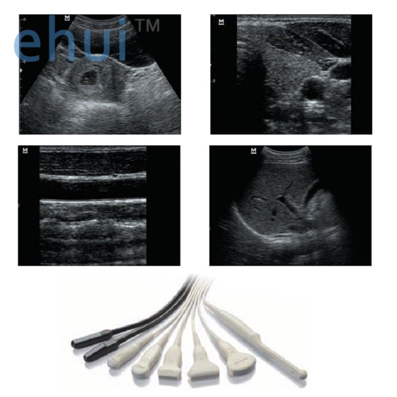 Digital portable ultrasound diagnostic system DP-20 B ultrasound machine