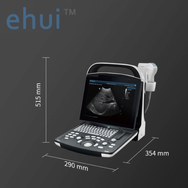 Digital portable ultrasound diagnostic system DP-20 B ultrasound machine