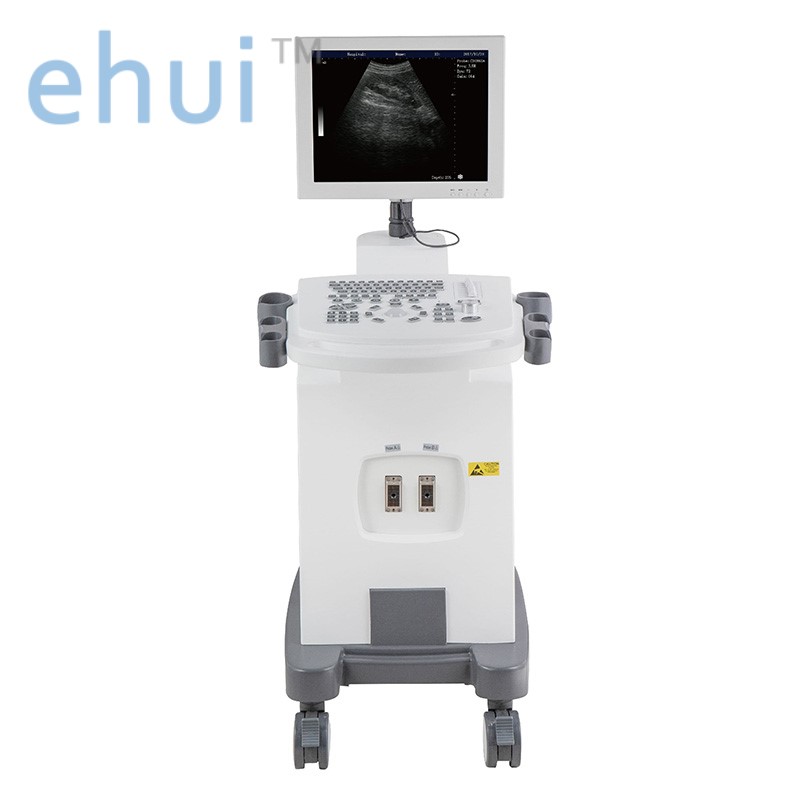 Low cost Trolley ultrasound full digital machine YH-350 ultrasound scan