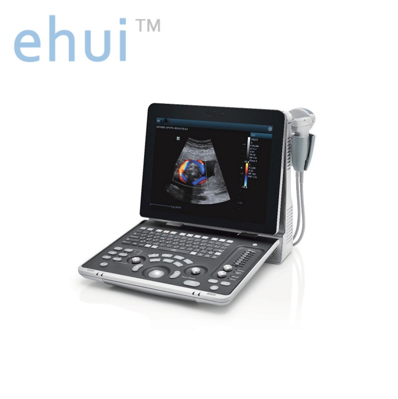 Portable full digital color ultrasound Z50BW outpatient ultrasound