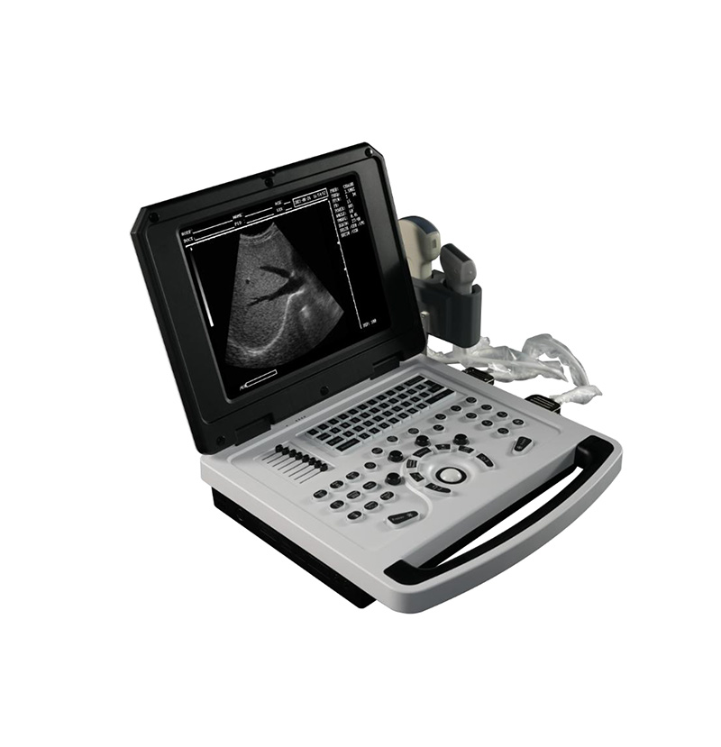 Full digital ultrasound diagnostic instrument notebook black and white B ultrasound machine