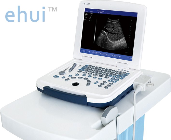 Portable laptop B/W ultrasound machine price full digital ultrasound scanner W580